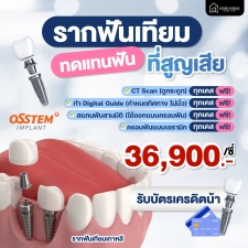 รากฟันเทียม 36900 บาท รวมครอบฟันเซรามิกแบบแพงแล้วด้วย